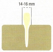 Disques 18 ondes ETS AURENSAN